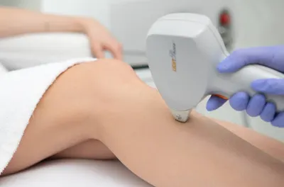 Depilacja laserowa - Instytut Urody "Ulala" Urszula Chojnowska